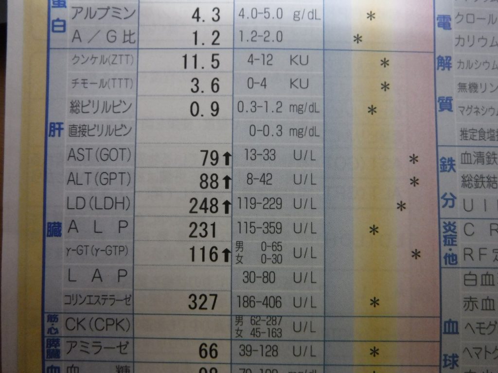 床下 屋根裏に入っての検査 は必須検査 床下 屋根裏に入っての検査 は必須検査